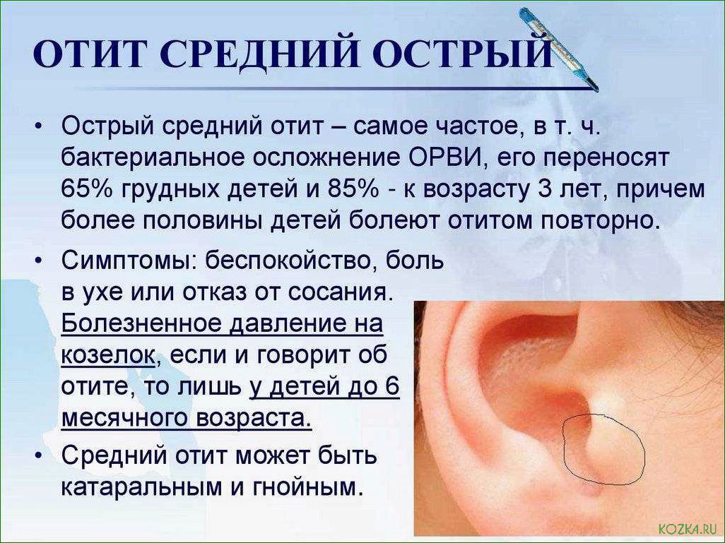 Уха рыбная: рецепты приготовления и особенности блюда